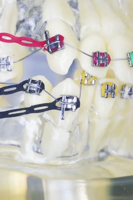 Orthodontic Wires & Bands